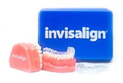 Invisalign1.jpg